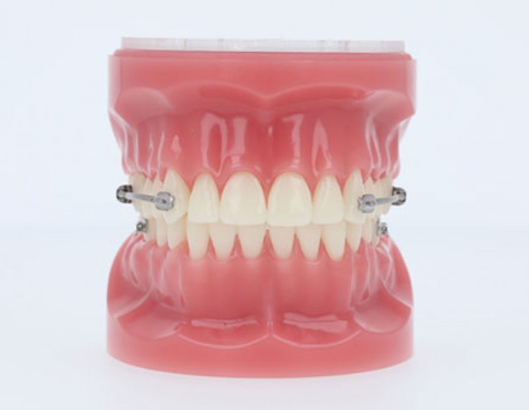 Virtual Product Library | American Orthodontics