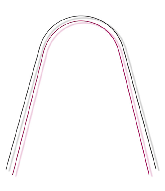 Arch Forms | American Orthodontics